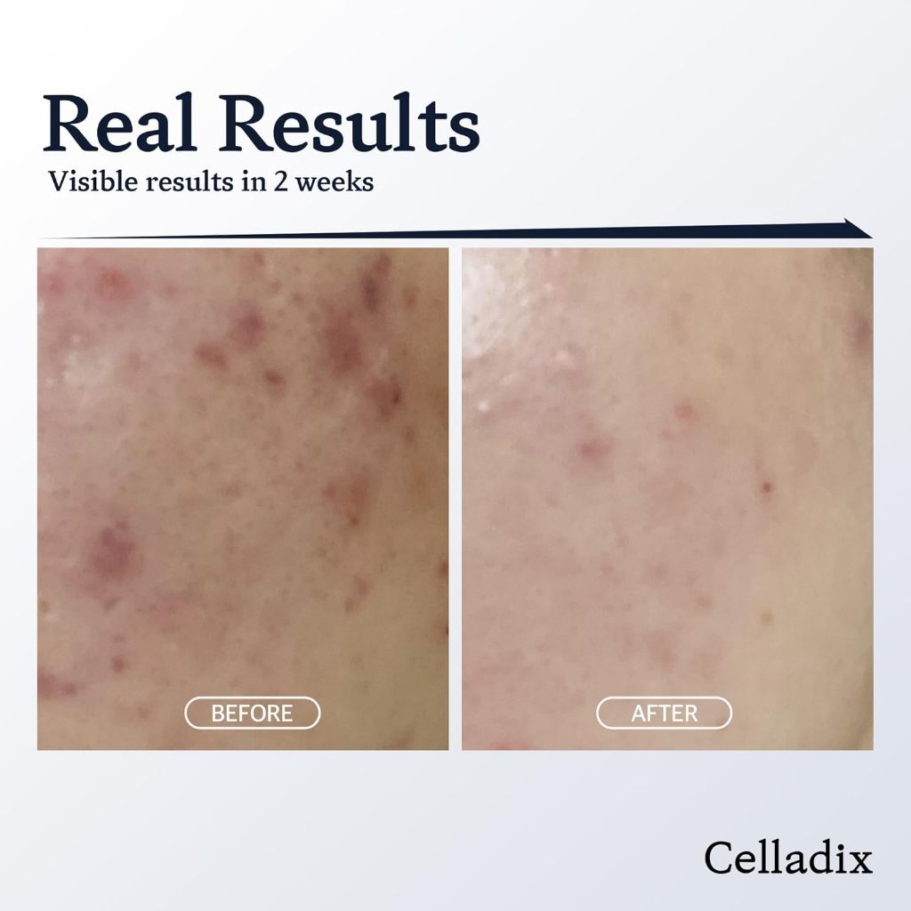 Xịt Dưỡng pH 5.5 Cân Bằng Da CELLADIX SKIN BALANCING PH 5.5 TONER MIST 120ml | DAMDAVN
