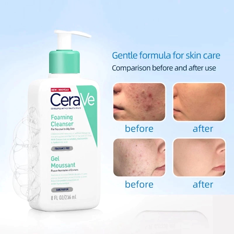 Sữa rửa mặt Cera ve 236ml/Daily Moisturizing Lotion&Sữa Rửa mặt/Moisturising Cream