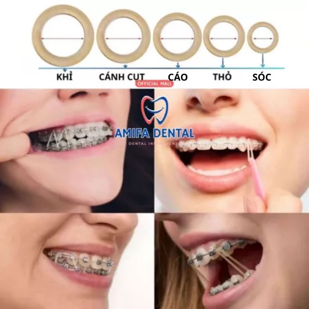 Chun Liên Hàm, Thun Kéo Niềng Răng, Chỉnh Nha, Thun Chỉnh Khớp Cắn, Thun Liên Hàm Gói 100 Chiếc