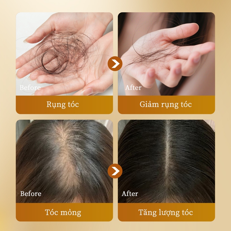 Dầu gội gừng Dầu gội mọc tóc Dầu gội chống rụng tóc Tóc mọc nhanh Giảm rụng tóc Chăm sóc tóc 300ml