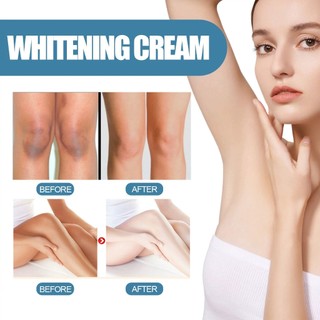Kem Trắng Da Giảm Thâm Nách, Mông, Đầu Gối, Khuỷu Tay SADOER 50g Vitamin C Whitening Mờ Đốm Thâm Và Dưỡng Ẩm Da
