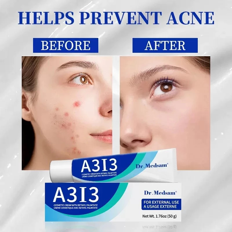 Kem A313 Retinol 50g Pháp/Retinoid Cream/Vitamin A Retinol cream Cosmetic Cream/Pommade