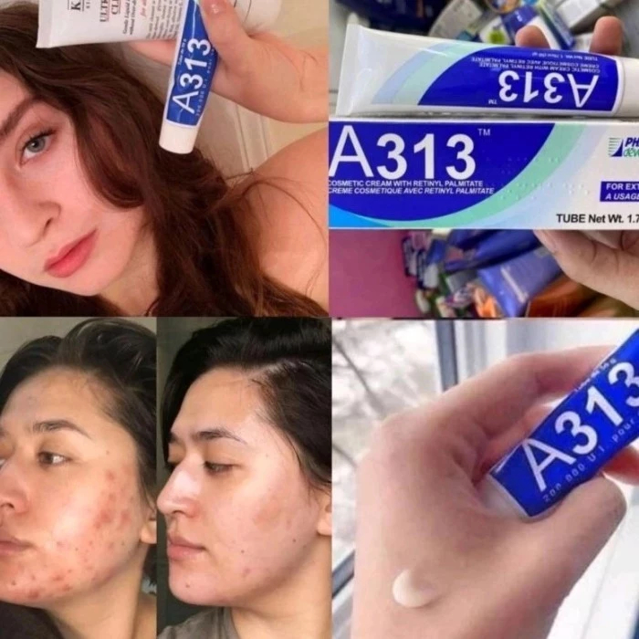 Kem A313 Retinol 50g Pháp/Retinoid Cream/Vitamin A Retinol cream Cosmetic Cream/Pommade