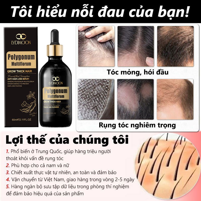 Serum mọc tóc Tinh chất thảo dược chống rụng tóc Giúp tóc mọc hiệu quả Nuôi dưỡng da đầu 50ml