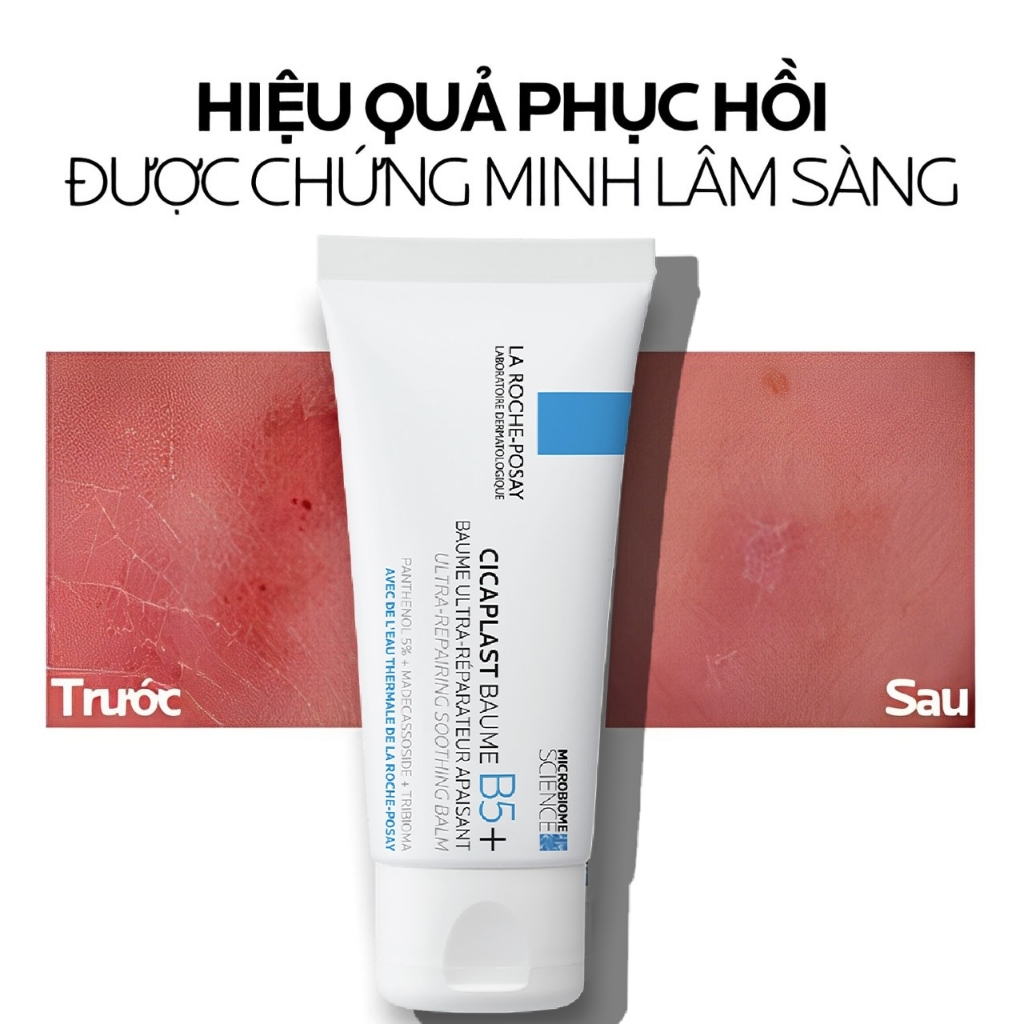 Thiết Kế Của Kem La Rocheposay Cicaplast Baume B5+ – Tái Tạo Da Cao Cấp