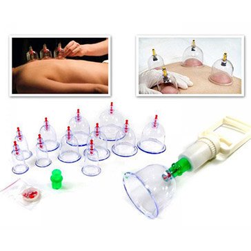 Bộ Dụng Cụ Giác Hơi Không Dùng Lửa Tiện Dụng Gồm 12 Ly