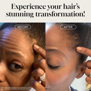 Pureauty Naturals Biotin Hair Growth Serum mọc tóc 60ml