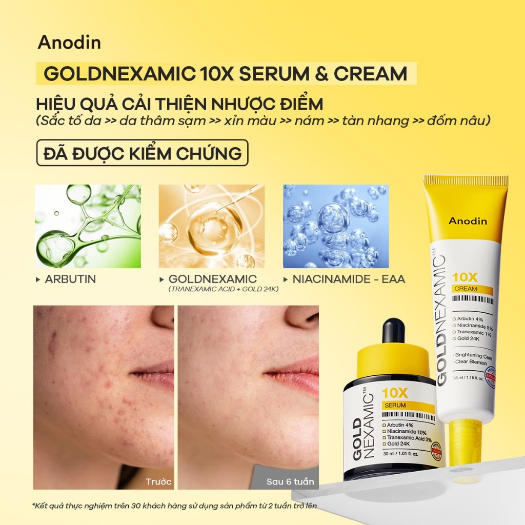 Combo Serum + Kem dưỡng dưỡng sáng, mờ thâm nám Goldnexamic 10x Anodin - Skin Studio