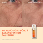 Tinh chất hỗ trợ sáng da, làm đều màu da Murad Vita-C Glycolic Serum 30ml — ảnh 4