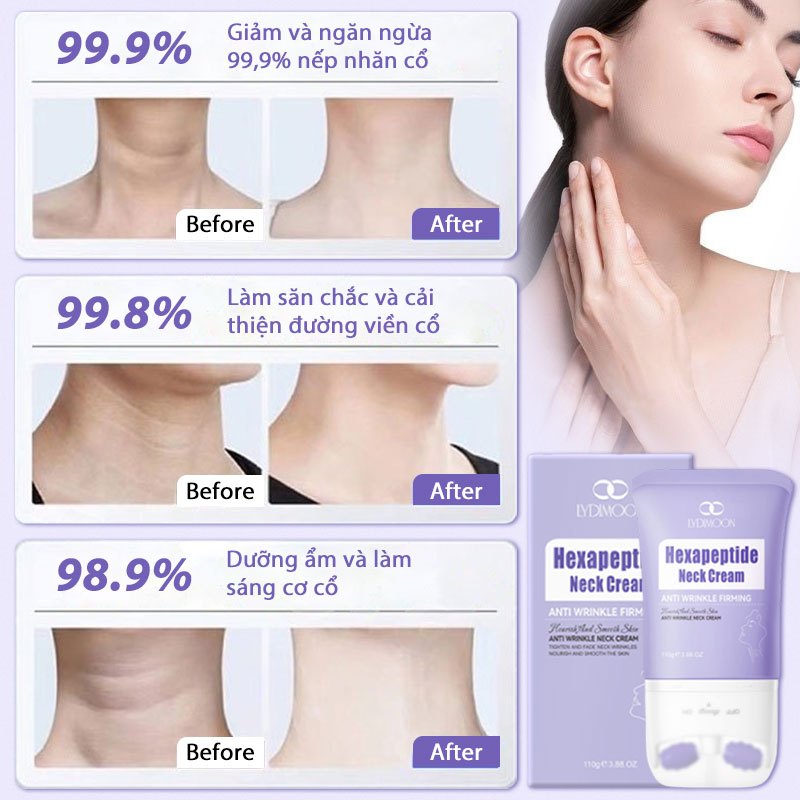 Kem chống nhăn cổ Kem cổ Kem massage cổ Xóa nếp nhăn cổ, nâng cơ da, làm trắng và dưỡng ẩm 110g
