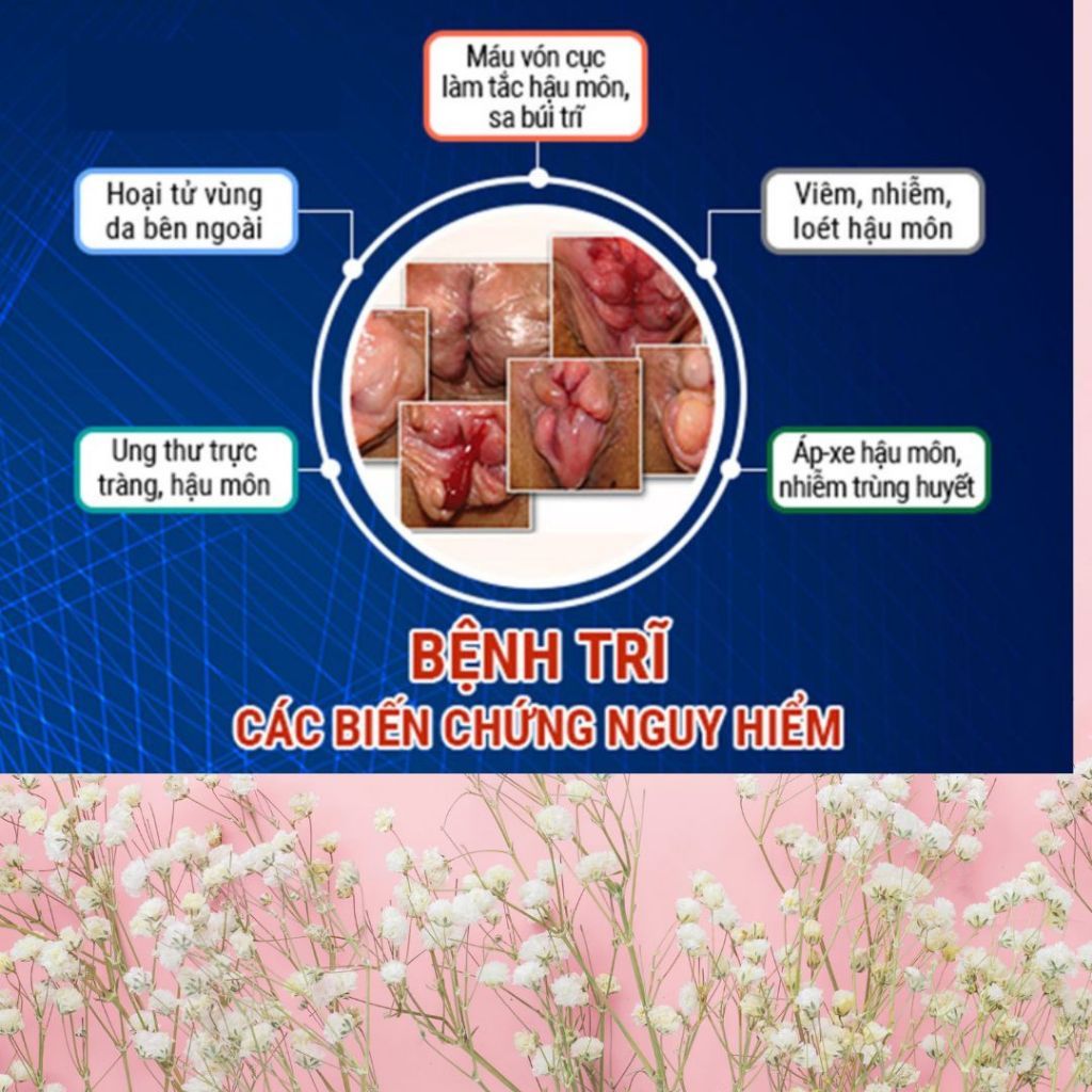 [Có Che Tên] Kem Bôi Trĩ - Bội Lan Đường - Trĩ, Táo Bón, ngứa rát, Giúp Co Nhanh Búi Trĩ - Hũ 20g
