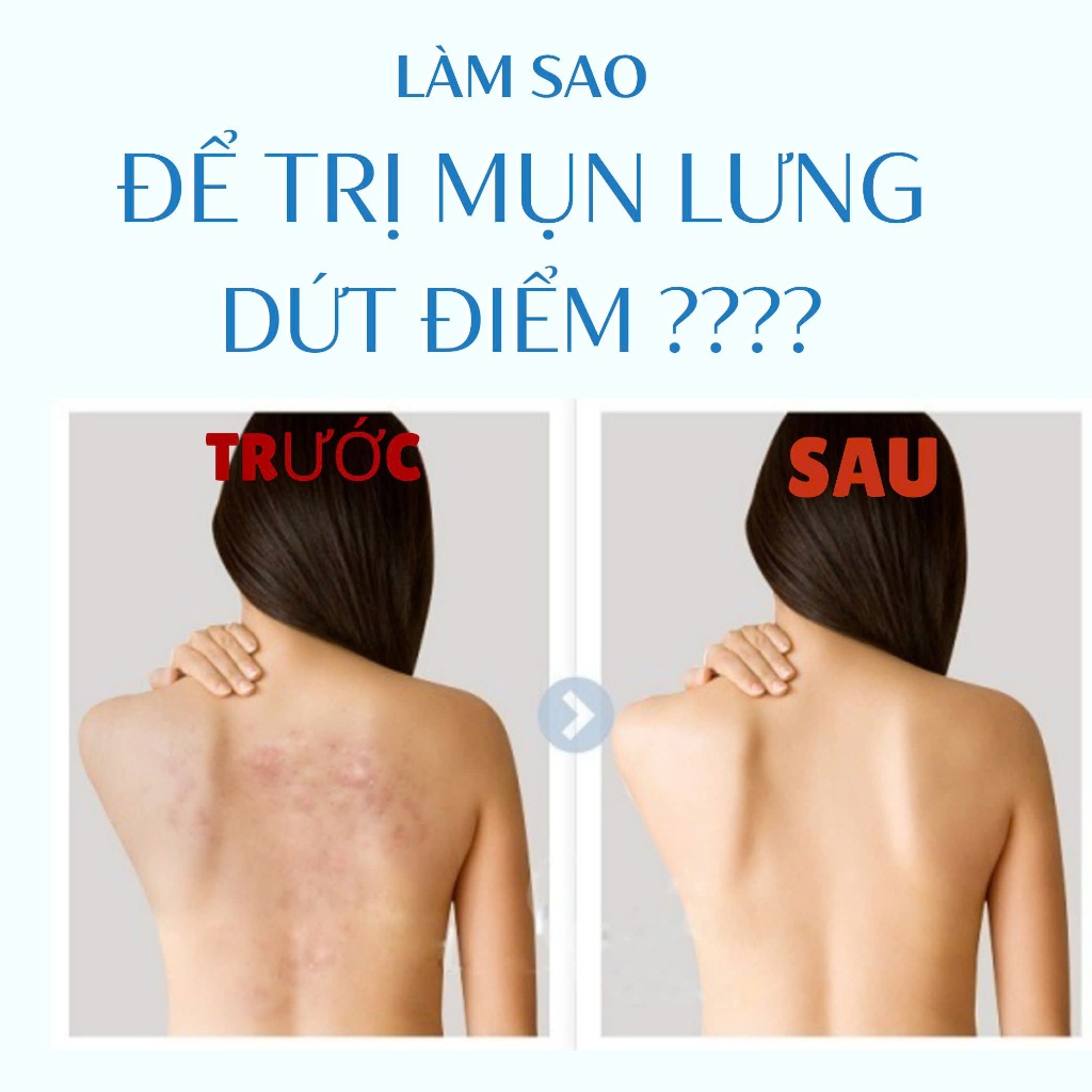 Pelican Xà Phòng Tắm Ngăn Ngừa Mụn Lưng For Back Soap Bar 50G (Phiên Bản Mini + túi lưới tạo bọt)