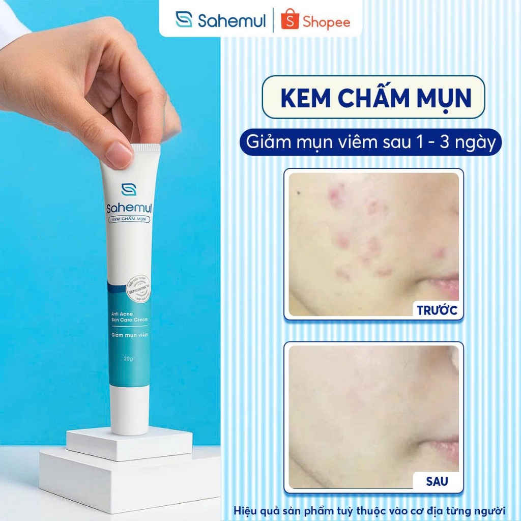 Kem Chấm Mụn Sahemul Giảm Mụn Viêm, Mụn Bọc, Mụn Mủ, Mụn Trứng Cá Hiệu ...