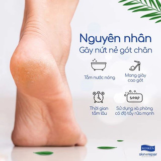 [HÀNG CÔNG TY] Gel Giảm Nứt Gót Chân & Ngăn Ngừa Chai Sạn Rosken Feet & Heel Balm (50g)