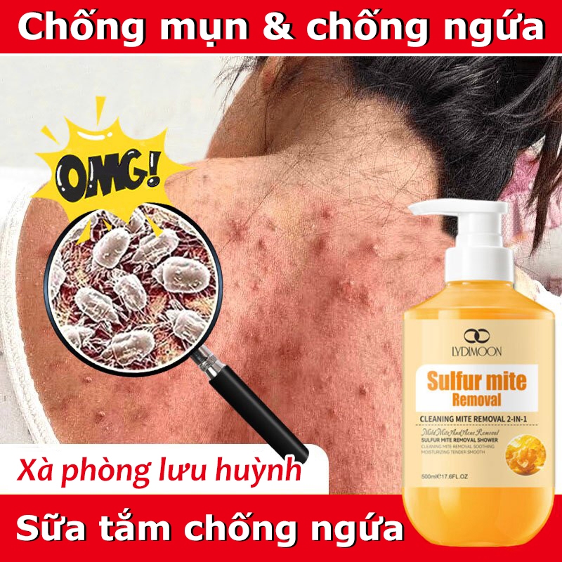 Sữa tắm xà phòng lưu huỳnh Sữa tắm chống ngứa Sữa tắm mụn Sữa tắm diệt mạt ve 500ml