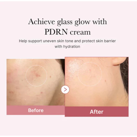 Kem dưỡng ẩm Medicube 50ml/PDRN Pink Hyaluronic Moisturizing Cream