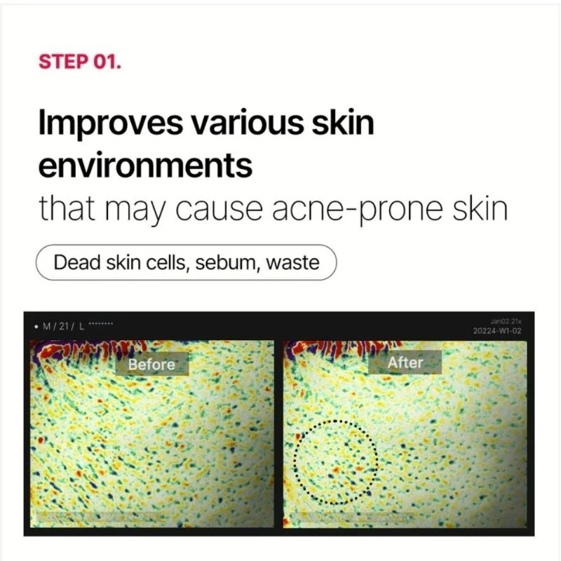 Toner pad dưỡng sáng giảm dầu mụn Medicube 70pad/Red Succinic Acid Peeling Pad