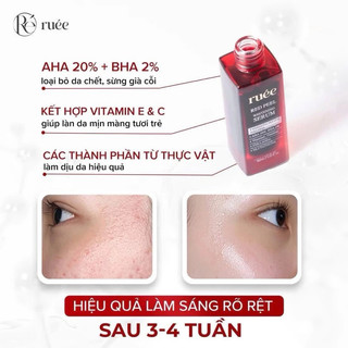 Peel Da Sinh Học Ruée - Tẩy Tế Bào Chết, Giảm Mụn Ẩn, Mờ Thâm, Sáng Da, Cấp Ẩm MP1005