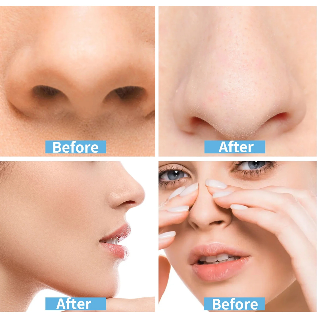Miếng dán chống ngáy thông mũi Breathe Right 30pcs/Nasal Strips Extra Strength/Opens Your Nose