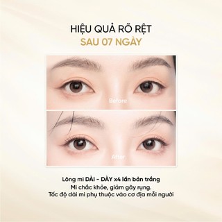 Serum Dưỡng Mi LONG4LASHES Gold 4ml, Serum Tái Tạo Phục Hồi Nang Mi, Hỗ Trợ Giảm Thâm Mắt