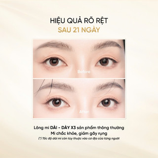 Serum Dưỡng Mi LONG4LASHES White 3ml, Serum Giảm Rụng Mi, Làm Dày, Dài Mi Xuất Xứ Ba Lan