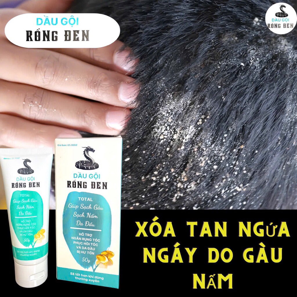 3Lọ 500ml Giảm Giá 70 % Dầu Gội thảo dược Rồng Đen  Giúp sạch Gàu nấm Ngăn dụng tóc Phục hồi tóc và da đầu bị tổn thương