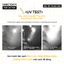 Dầu tẩy trang BE THE SKIN Pore Reset Glass Skin Cleansing Oil 150ml