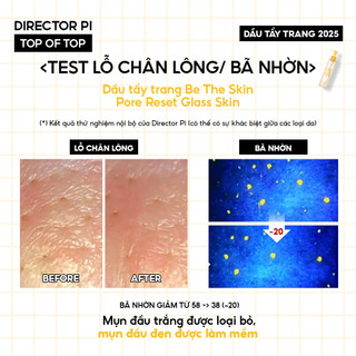[KOL] Dầu tẩy trang BE THE SKIN Pore Reset Glass Skin Cleansing Oil 150ml