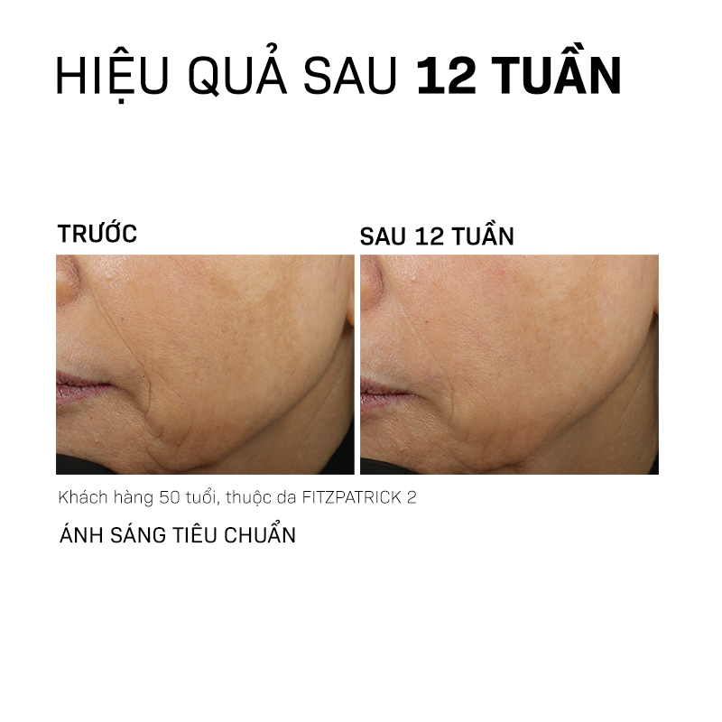 Kem Dưỡng Trẻ Hóa Màng Đáy Và Nâng Cấp Chất Lượng Da Toàn Diện REVISION SKINCARE D·E·J Face Cream 48g