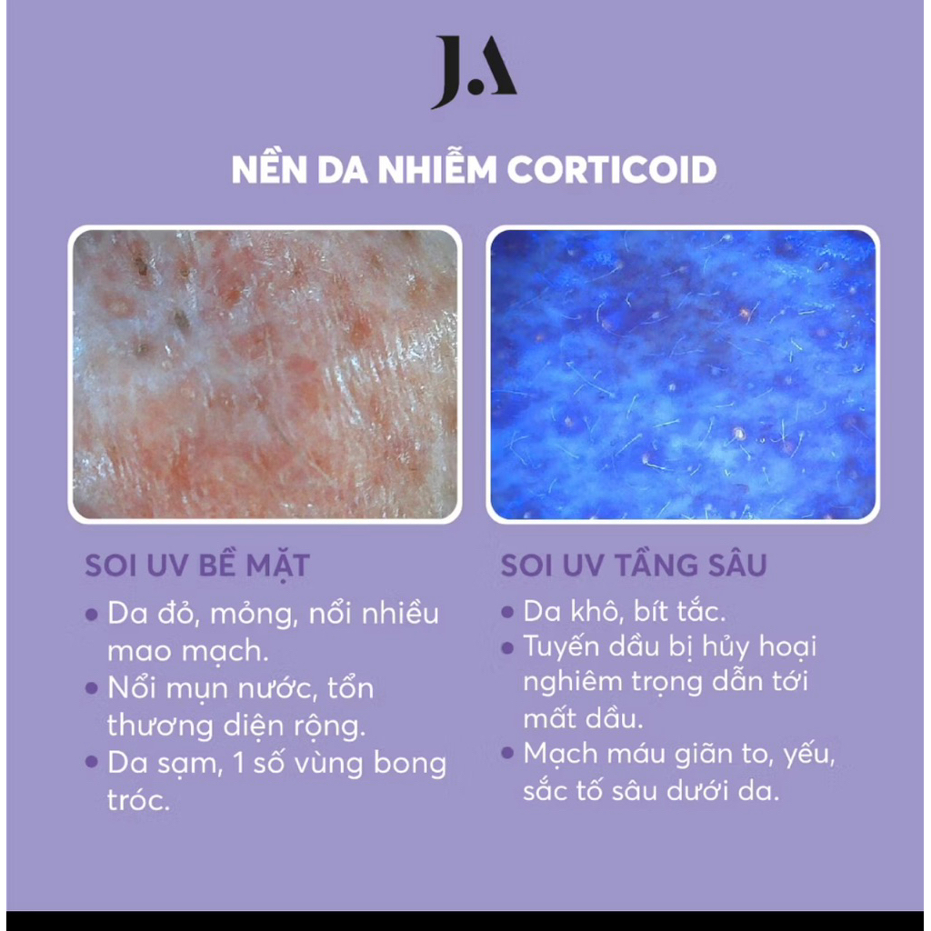 [Hàng công ty] Tinh chất lô hội ALOE VERA SERUM - Juliette Armand