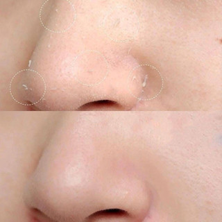 [Caryophy] Gel tẩy tế bào chết da ngăn ngừa mụn Caryophy Smart Peeling Gel 250ml