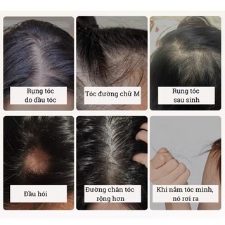 Dầu Gội thảo dược  Đồng Nhân Đường Kích Thích Mọc Tóc Nội Địa Trung, Giúp Dưỡng Ẩm Kiểm Soát Dầu, Ngăn Rụng Tóc
