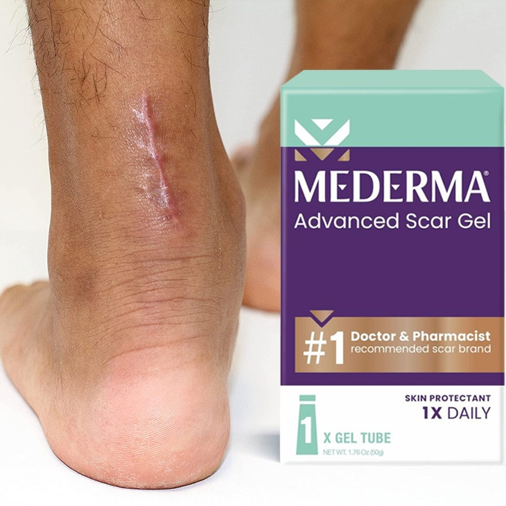 Gel Làm Mờ Sẹo Mederma Advanced Scar Gel Skin Protectant 50g