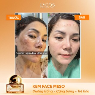 Kem Face Meso Tế Bào Gốc Lycos 20g – Sáng Mịn, Bật Tone & Phục Hồi Da – Tặng 1 Serum Cốt Hoa