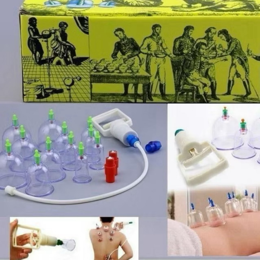 bộ giác hơi 12 ly nhựa trong suốT – KHÔNG LỬA, KHÔNG BỎNG, KHÔNG TRUYỀN NHIỄM – AN TOÀN CHO MỌI NGƯỜI