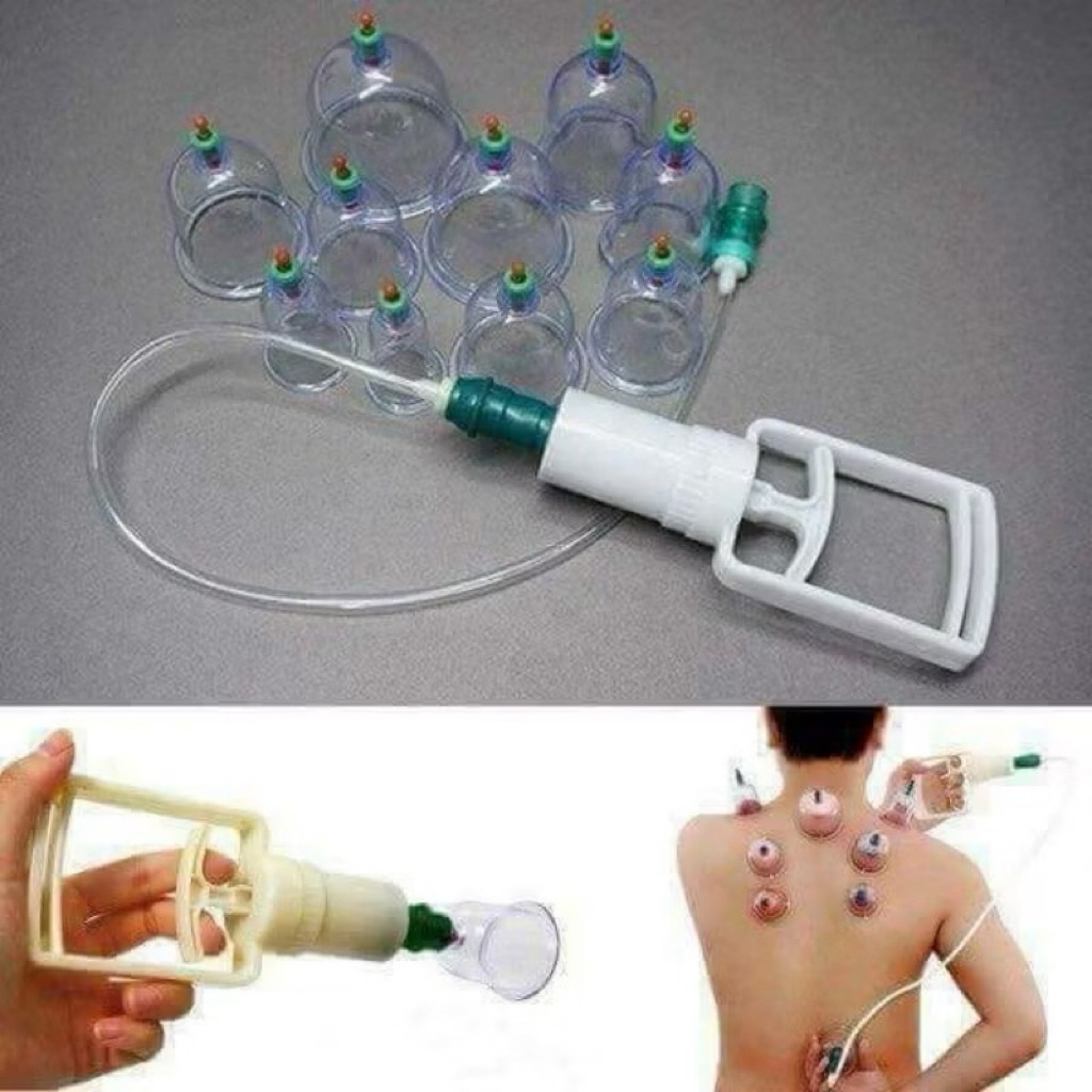 bộ giác hơi 12 ly nhựa trong suốT – KHÔNG LỬA, KHÔNG BỎNG, KHÔNG TRUYỀN NHIỄM – AN TOÀN CHO MỌI NGƯỜI