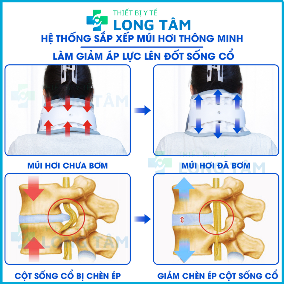 Đai Hơi Kéo Giãn Cột Sống Cổ ZSK LA Y 20 Đai Kéo Giãn Hỗ Trợ Giảm Chèn Ép Dây Thần Kinh Vùng Cổ