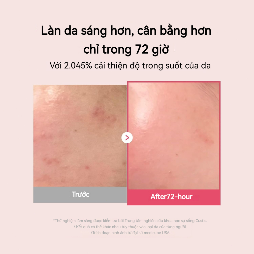 Serum Dưỡng Sáng Medicube TXA + Niacinamide 15% 30ml - Chăm Sóc Da Sau Mụn, Cải Thiện Sắc Tố & Cấp Ẩm