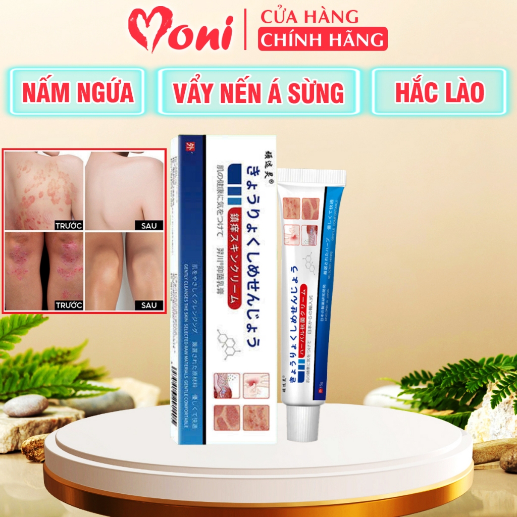 Kem Bôi Nấm Ngứa Viêm Da Cơ Địa NHẬT BẢN, dứt điểm Hắc lào, Tổ đỉa, Vẩy nến, Nấm Da đầu, Ghẻ nước Tay Chân Hiệu Quả