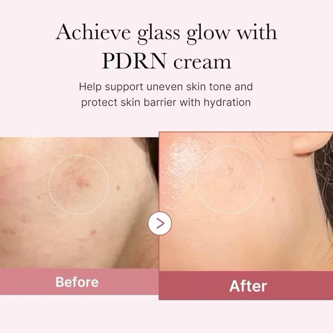 Kem Dưỡng Ẩm Medicube PDRN Pink Hyaluronic Moisturizing Cream 50ml – Kem Cấp Ẩm, Phục Hồi Da, Làm Dịu Da