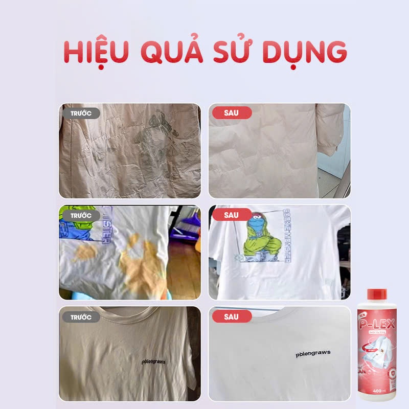 Xịt Tẩy Trắng Quần Áo PLEX 400ml – Tẩy Vết Ố, Mốc, Mực, Dầu Mỡ – Không Phai Màu – An Toàn Da Tay