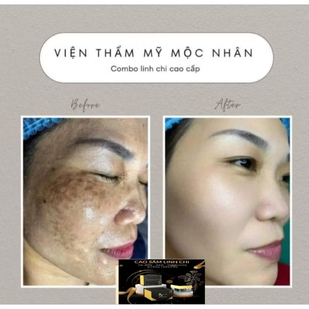 Chính Hãng Kem Cao Sâm Mộc Nhân T ái Tạo Loại Bỏ Mụn Nám Lổ chân lông to da ko đều màu
