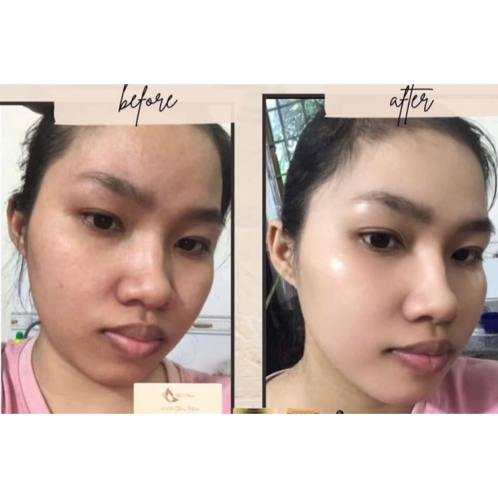 Chính Hãng Kem Face Colagen HA Mộc Nhân Làm Trắng Sáng Da Đều Màu Da Chống Lão Hóa Ngừa Mụn Mờ Thâm Sạm An Lành Tính