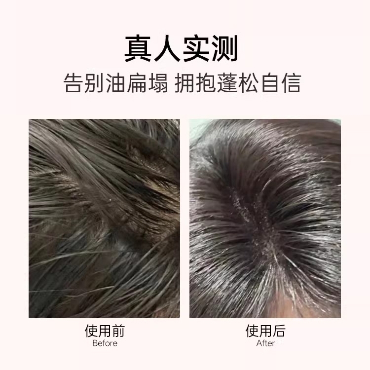 Dầu gội Đầu TAGLASE Lựa chọn hoàn hảo cho mái tóc chắc khỏe Tăng cường ...