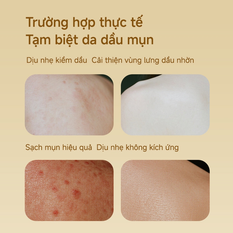 Sữa tắm xà phòng lưu huỳnh Sữa tắm chống ngứa Sữa tắm mụn Sữa tắm diệt mạt ve 500ml