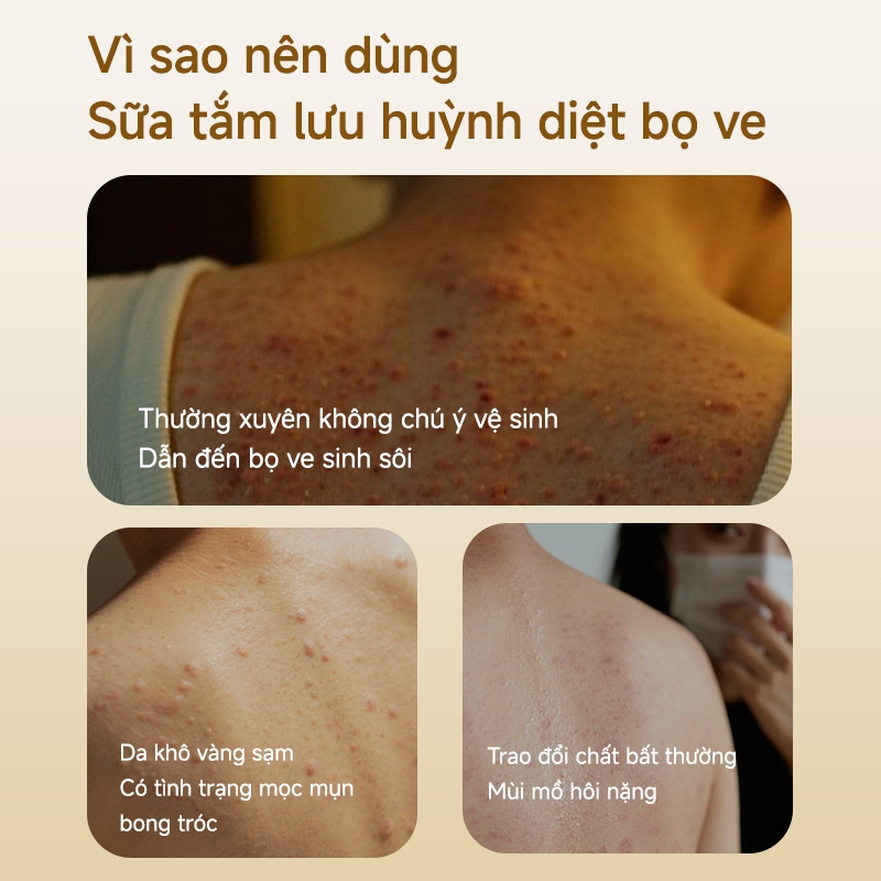 Sữa tắm xà phòng lưu huỳnh Sữa tắm chống ngứa Sữa tắm mụn Sữa tắm diệt mạt ve 500ml