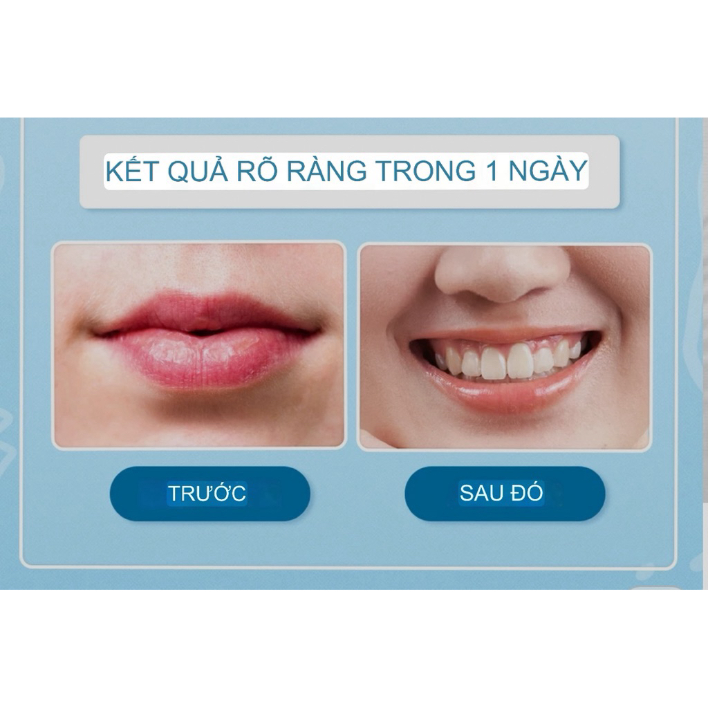 [Bill Úc]Son Dưỡng Môi Dermal Therapy Lip Balm Chính Hãng Úc – 6 Mùi – Dưỡng Ẩm, Giảm Khô Nứt, Làm Mềm Môi