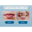 Son Dưỡng Môi Dermal Therapy Lip Balm Chính Hãng Úc – 6 Mùi – Dưỡng Ẩm, Giảm Khô Nứt, Làm Mềm Môi