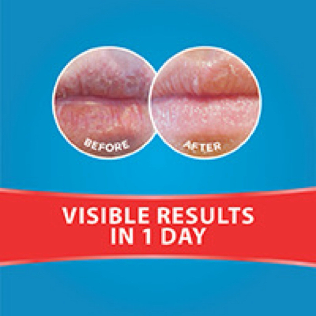 [Bill Úc]Son Dưỡng Môi Dermal Therapy Lip Balm Chính Hãng Úc – 6 Mùi – Dưỡng Ẩm, Giảm Khô Nứt, Làm Mềm Môi