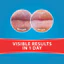 Son Dưỡng Môi Dermal Therapy Lip Balm Chính Hãng Úc – 6 Mùi – Dưỡng Ẩm, Giảm Khô Nứt, Làm Mềm Môi